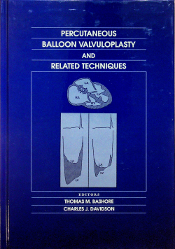 Percutaneous ballon valvuloplasty and related techniques