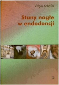 Stany nagłe w endodoncji