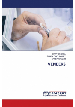 Veneers