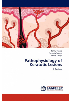 Pathophysiology of Keratotic Lesions