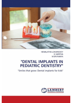 "dental Implants In Pediatric Dentistry"