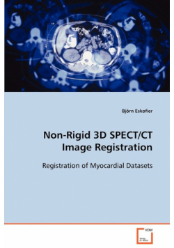 Non-Rigid 3D SPECT/CT Image Registration
