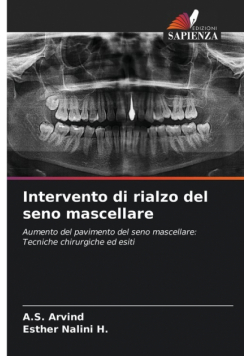 Intervento di rialzo del seno mascellare