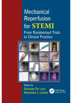 Mechanical Reperfusion for STEMI