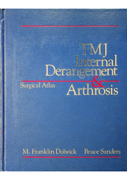 TMJ Internal Derangement and Arthrosis