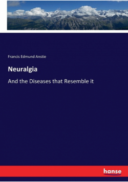 Neuralgia