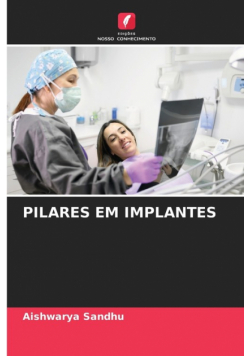 Pilares Em Implantes