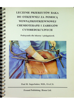 Leczenie przerzutów raka do otrzewnej
