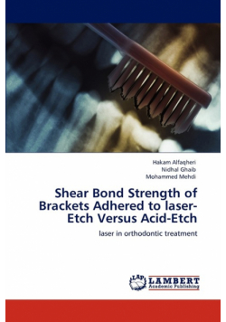Shear Bond Strength of Brackets Adhered to laser-Etch Versus Acid-Etch