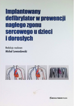 Implantowany defibrylator w prewencji nagłego zgonu sercowego u dzieci i dorosłych