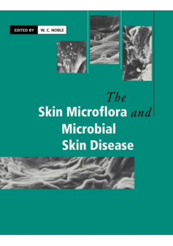 The Skin Microflora and Microbial Skin Disease