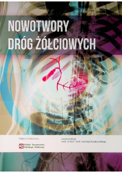 Nowotwory dróg żółciowych