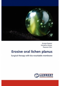 Erosive oral lichen planus