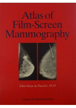 Atlas of film screen mannorpahy