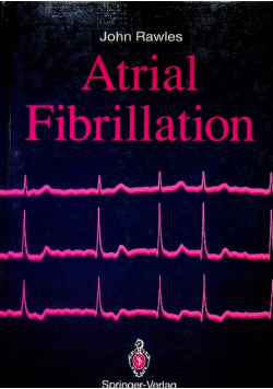 Atrial Fibrillation
