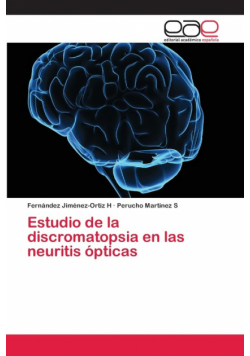 Estudio de la discromatopsia en las neuritis ópticas