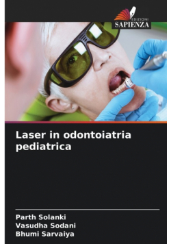 Laser in odontoiatria pediatrica