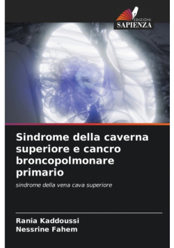 Sindrome della caverna superiore e cancro broncopolmonare primario