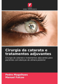 Cirurgia da catarata e tratamentos adjuvantes