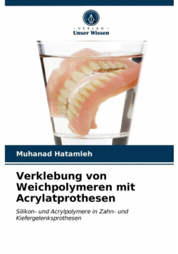 Verklebung von Weichpolymeren mit Acrylatprothesen