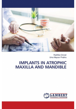 Implants In Atrophic Maxilla And Mandible