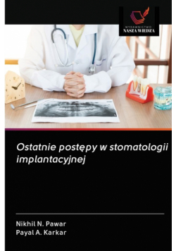 Ostatnie postępy w stomatologii implantacyjnej