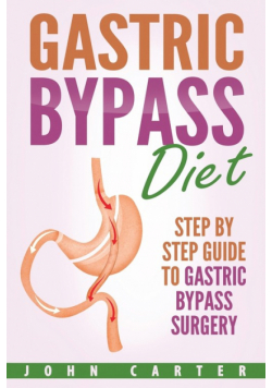 Gastric Bypass Diet