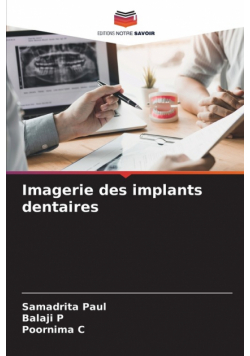 Imagerie des implants dentaires