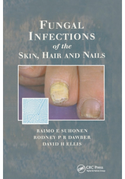 Fungal Infections of the Skin and Nails