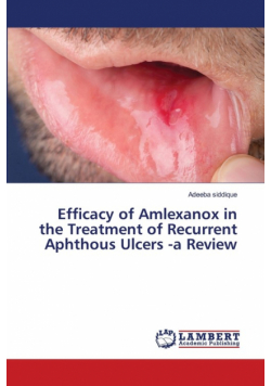 Efficacy of Amlexanox in the Treatment of Recurrent Aphthous Ulcers -a Review
